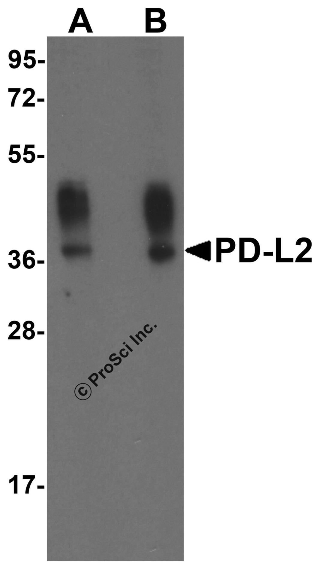 Western blot analysis of PD-L2 in overexpressing HEK293 cells PD-L2 antibody at 0.5 and 1 &#956;g/ml