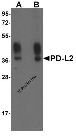 Western blot analysis of PD-L2 in overexpressing HEK293 cells PD-L2 antibody at 0.5 and 1 &#956;g/ml