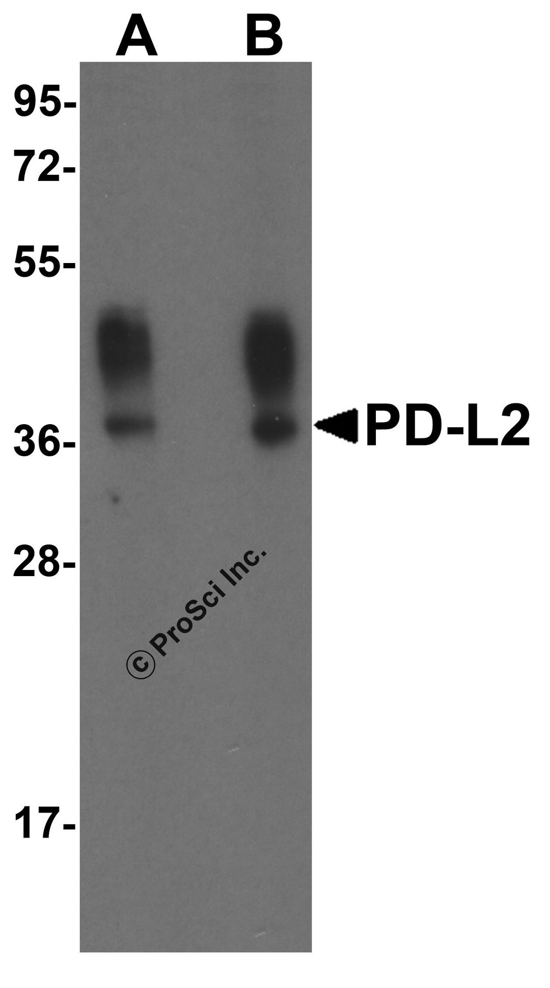 Western blot analysis of PD-L2 in overexpressing HEK293 cells PD-L2 antibody at 0.5 and 1 μg/ml