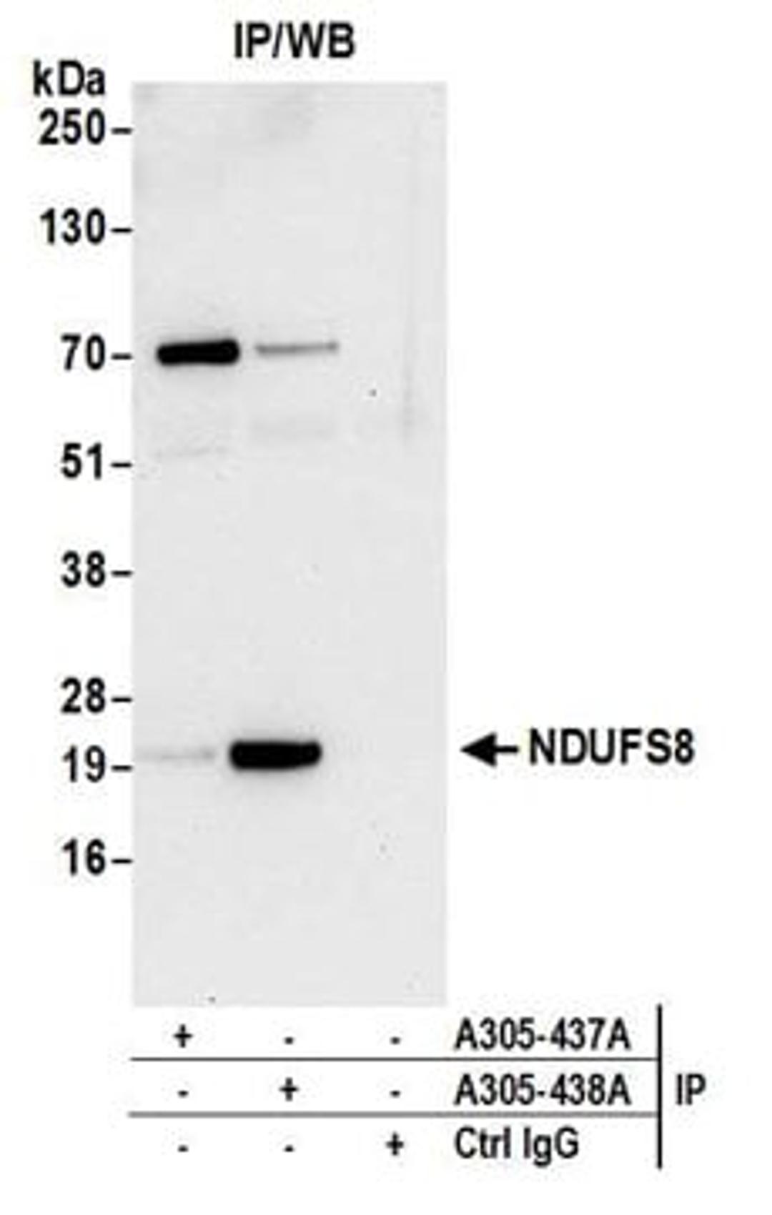 Detection of human NDUFS8 by western blot of Immunoprecipitates.