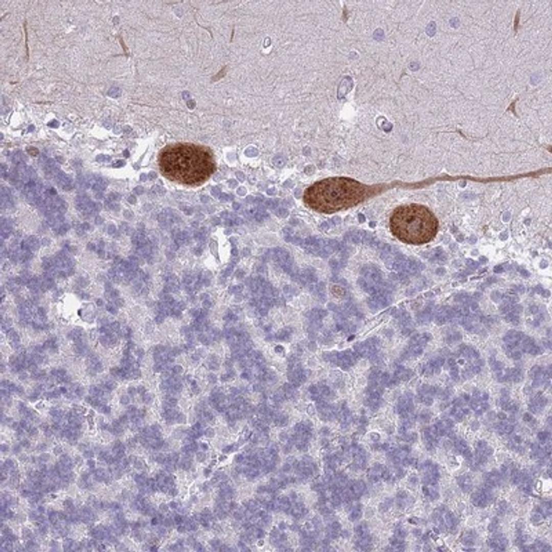 Immunohistochemistry-Paraffin: G-substrate Antibody [NBP2-13800] Staining of human cerebellum shows strong cytoplasmic and nuclear positivity in Purkinje cells.