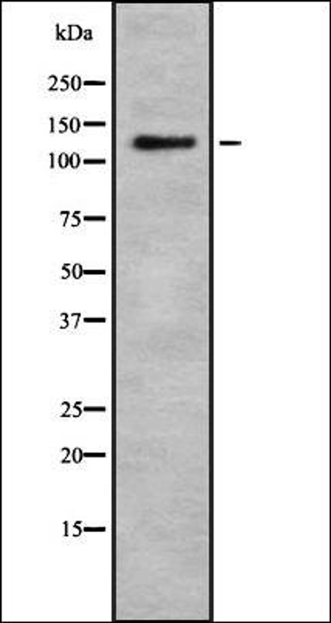 Western blot analysis of HEK293 cells using RB6I2 antibody