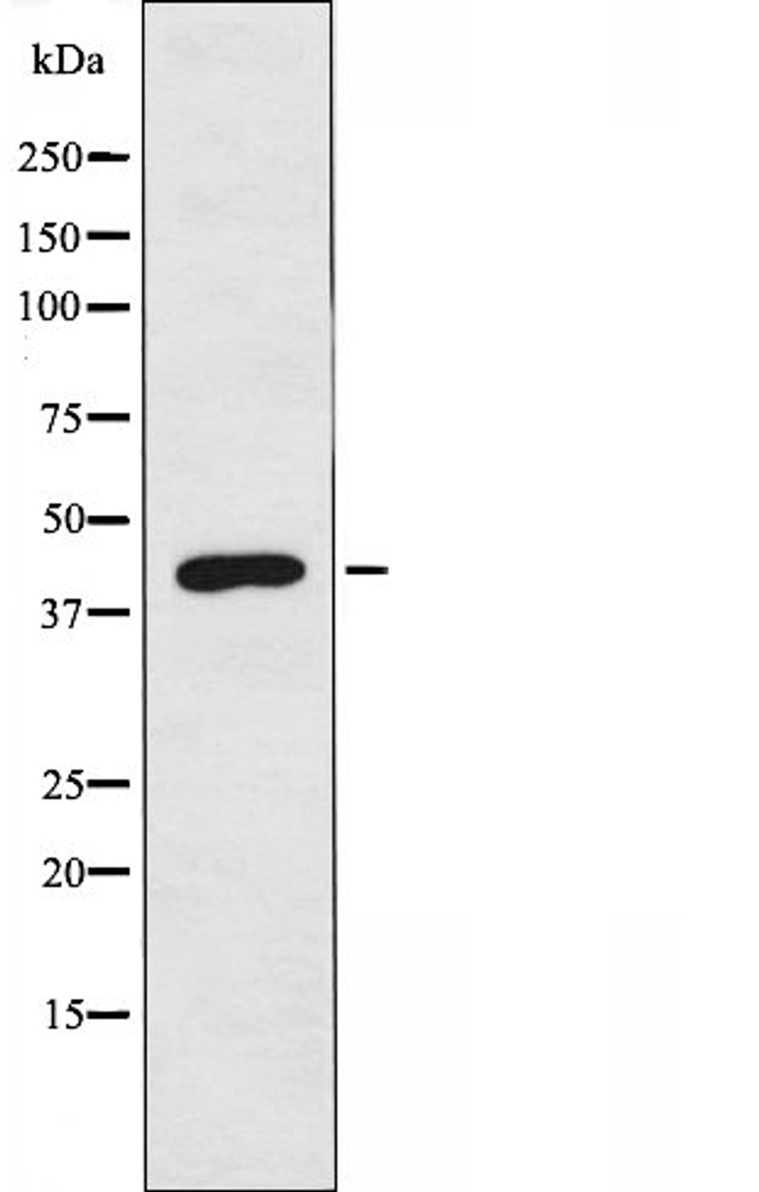 Western blot analysis of 293 cells and HepG2 cells using KAP2 antibody