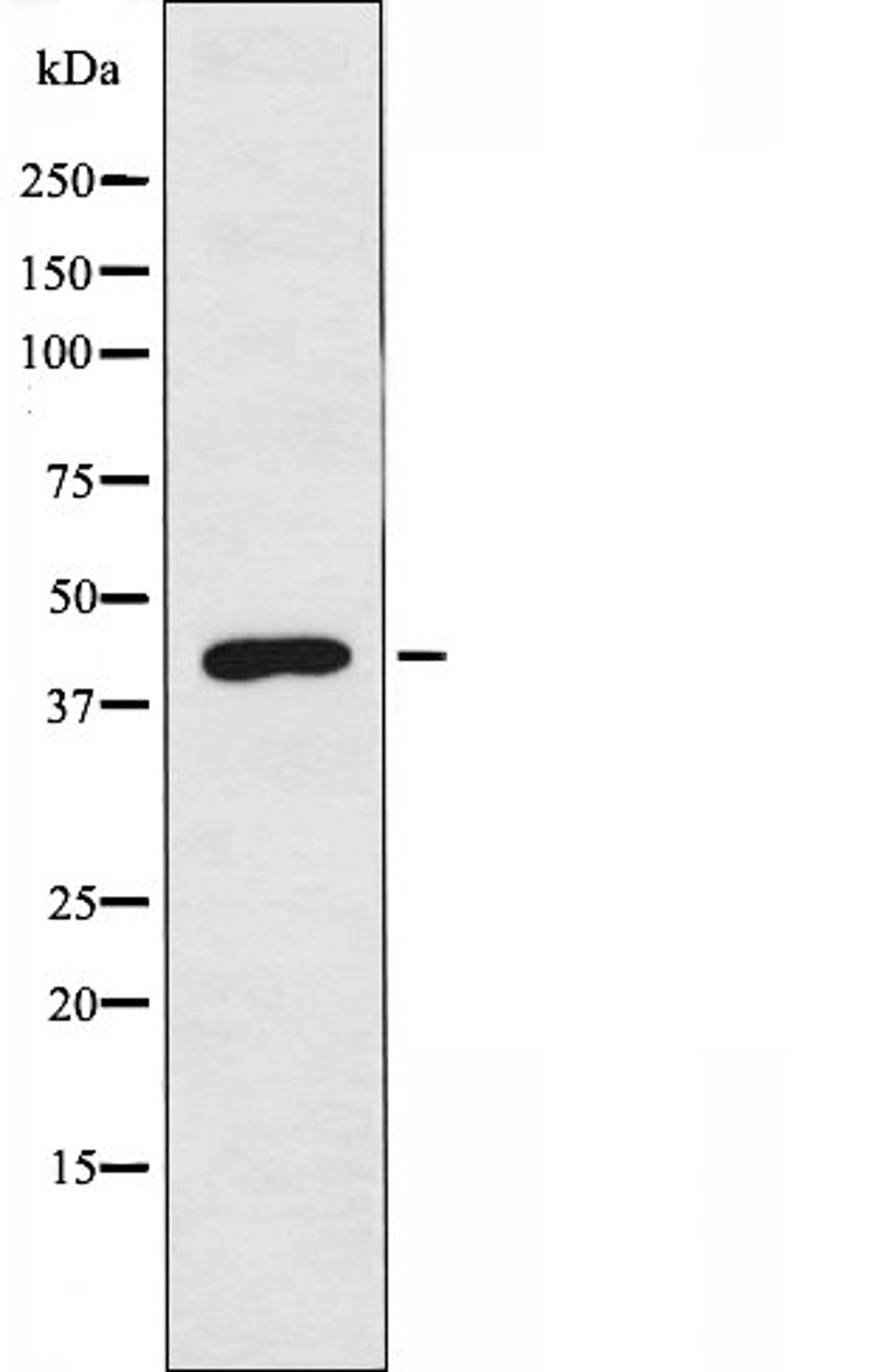 Western blot analysis of RAW264.7 cells using GPR109 antibody