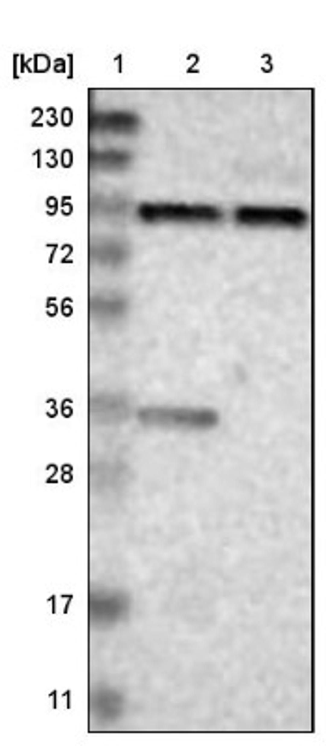 Immunohistochemistry: KIAA1024 Antibody [NBP1-90947] - Lane 1: Marker [kDa] 230, 130, 95, 72, 56, 36, 28, 17, 11<br/>Lane 2: Human cell line RT-4<br/>Lane 3: Human cell line U-251MG sp