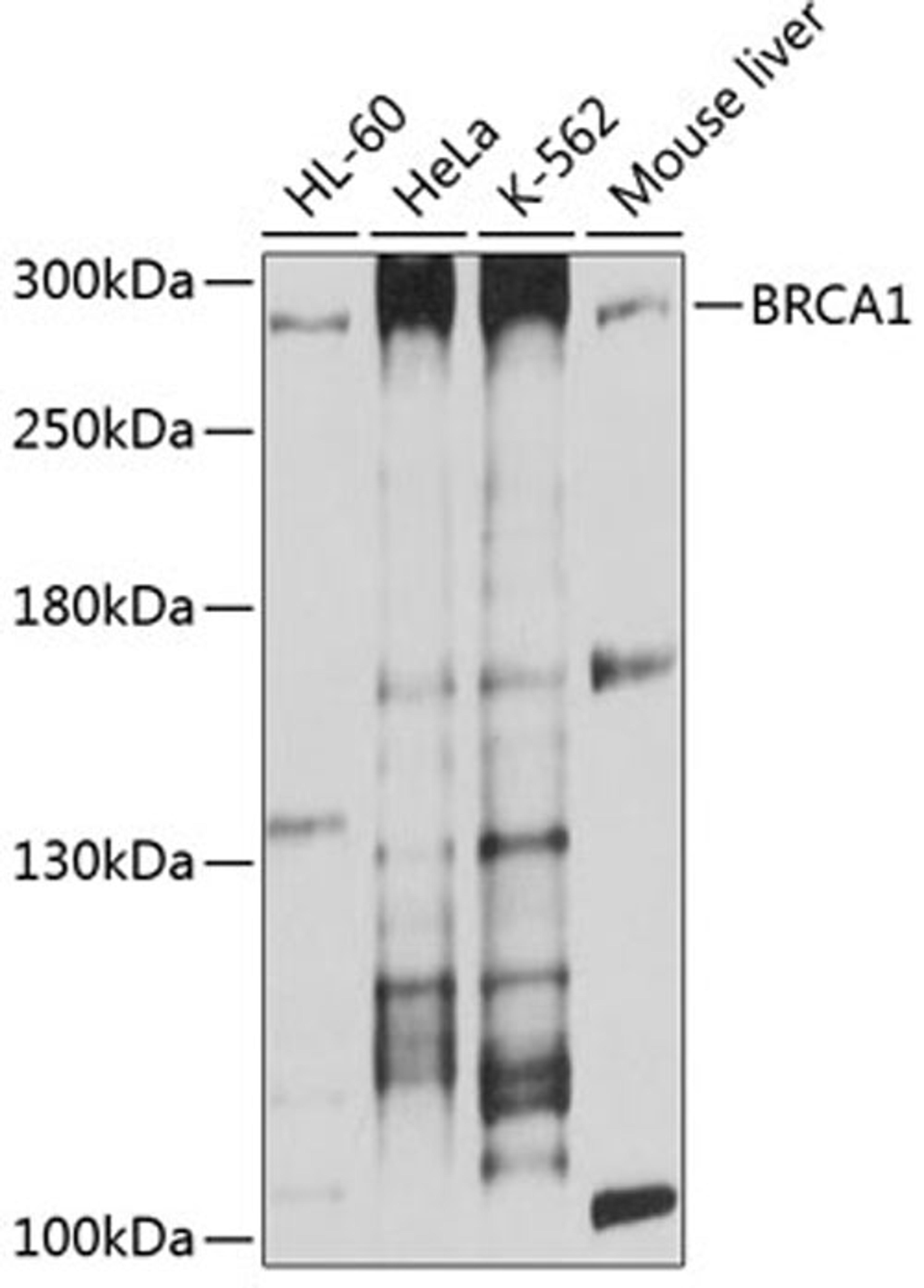 Western blot - BRCA1 antibody (A11034)