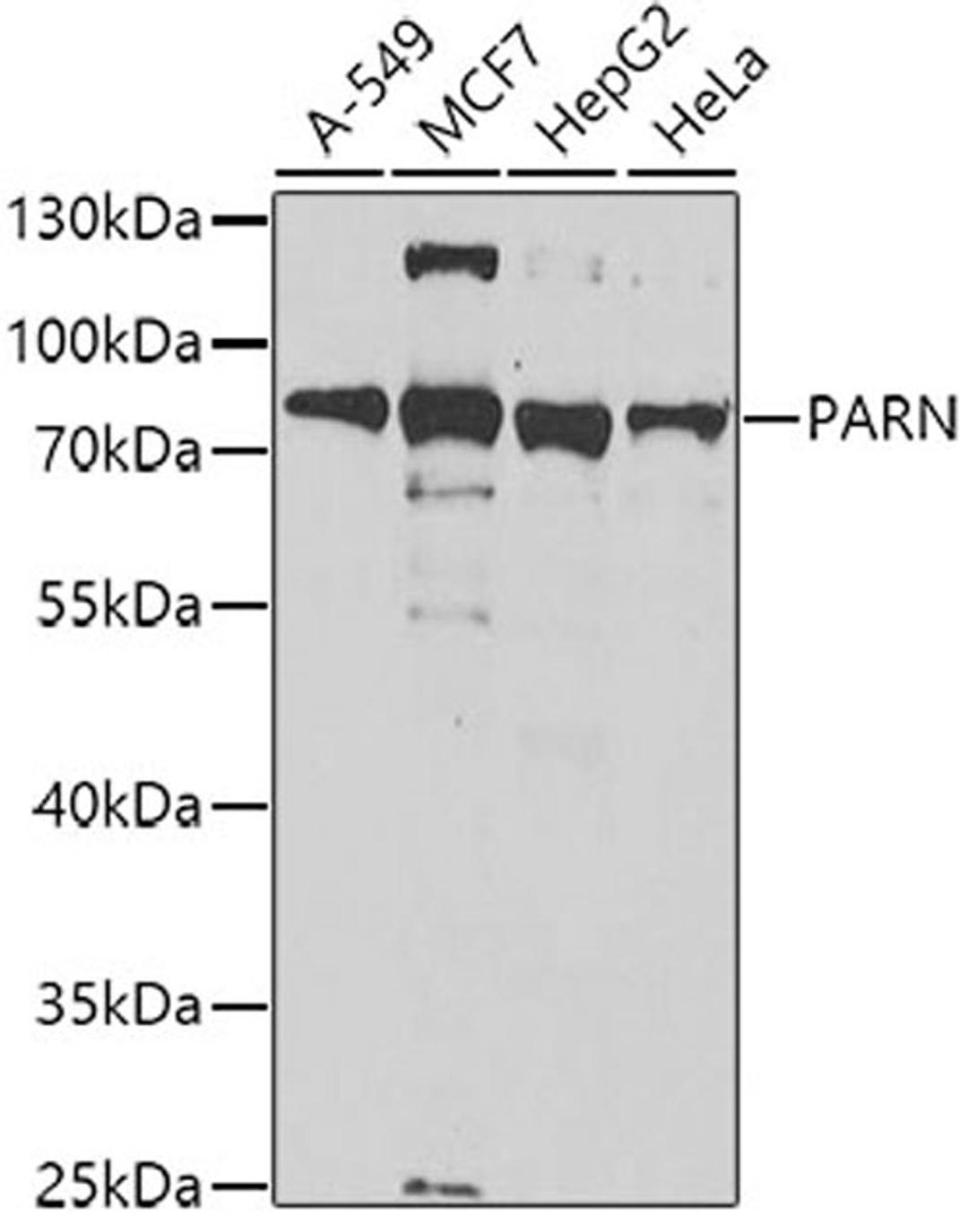 Western blot - PARN antibody (A6941)