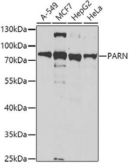 Western blot - PARN antibody (A6941)