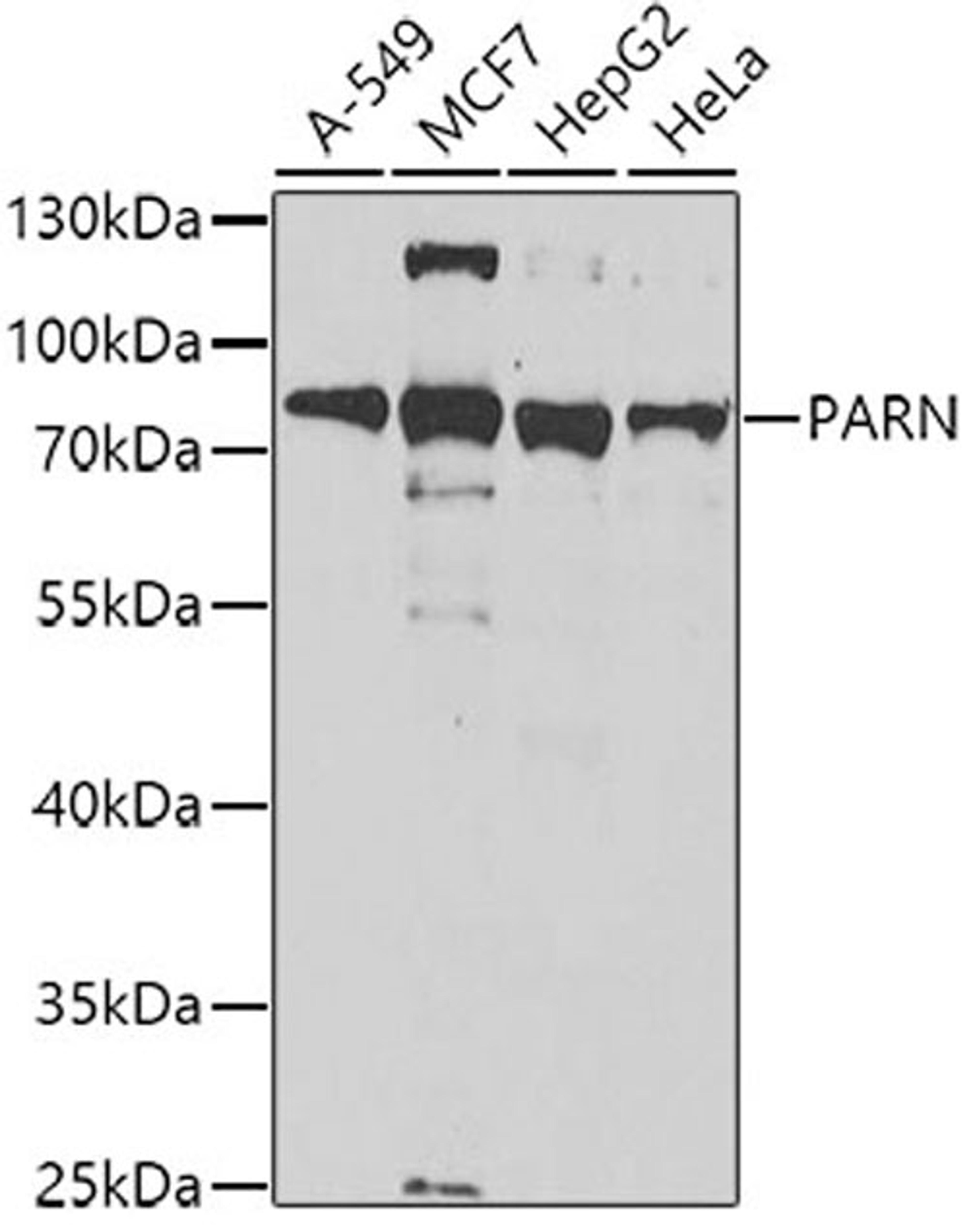 Western blot - PARN antibody (A6941)