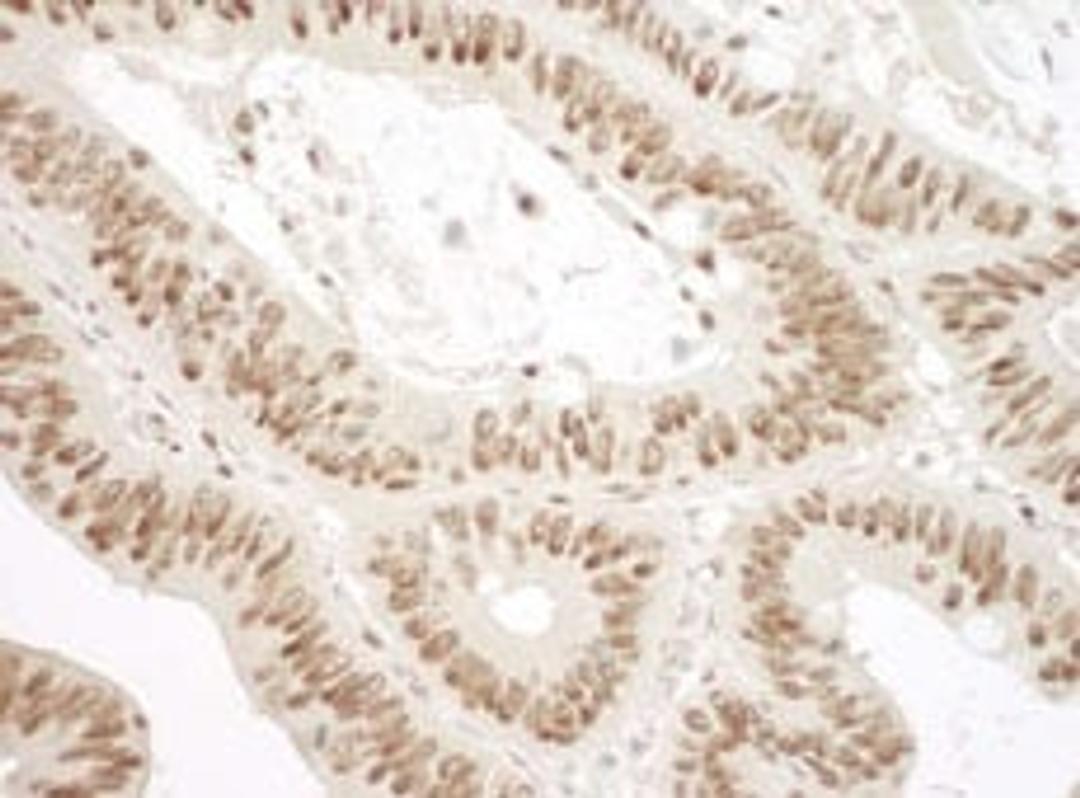 Detection of human Ku70 by immunohistochemistry.