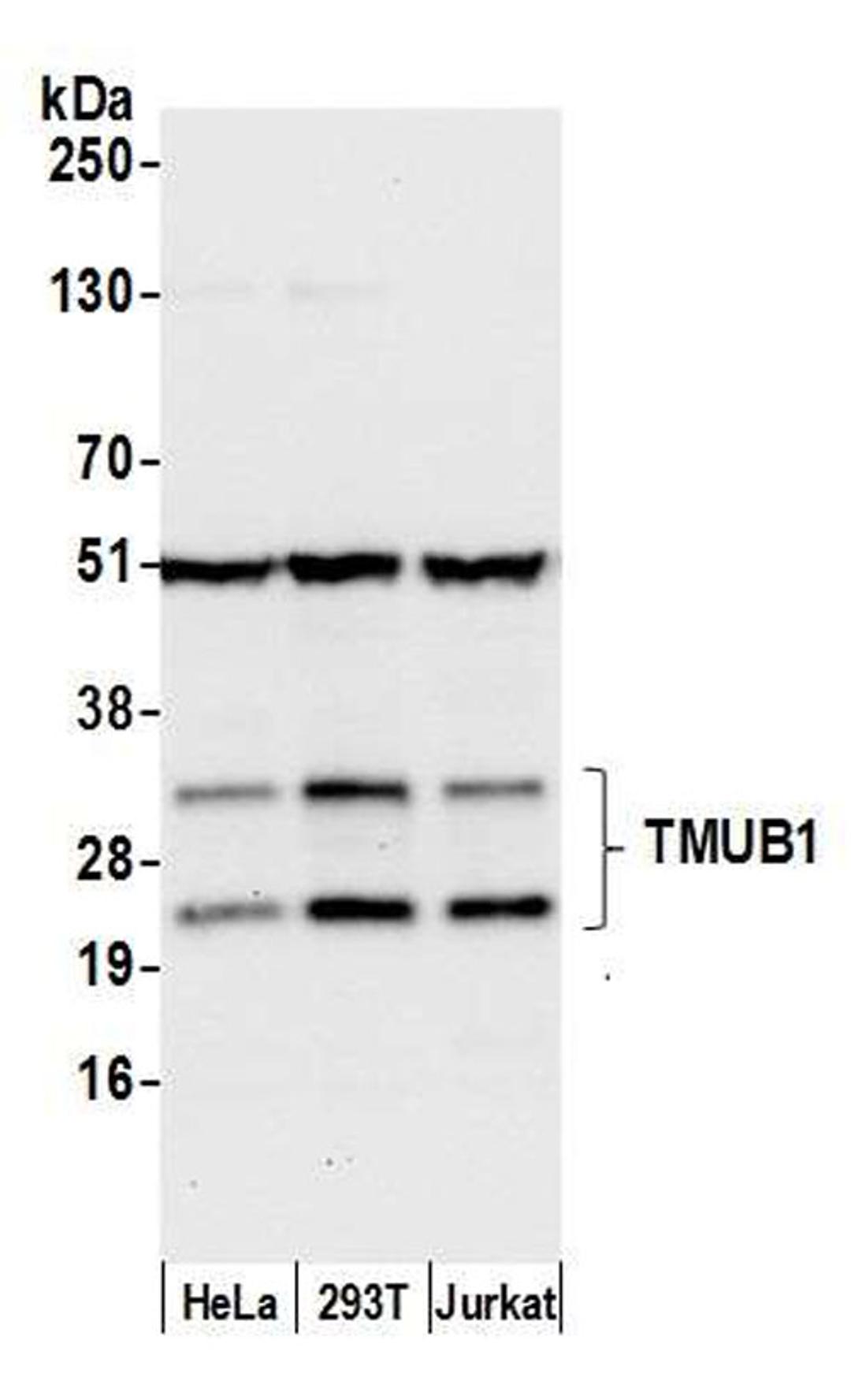 Detection of human TMUB1 by WB.