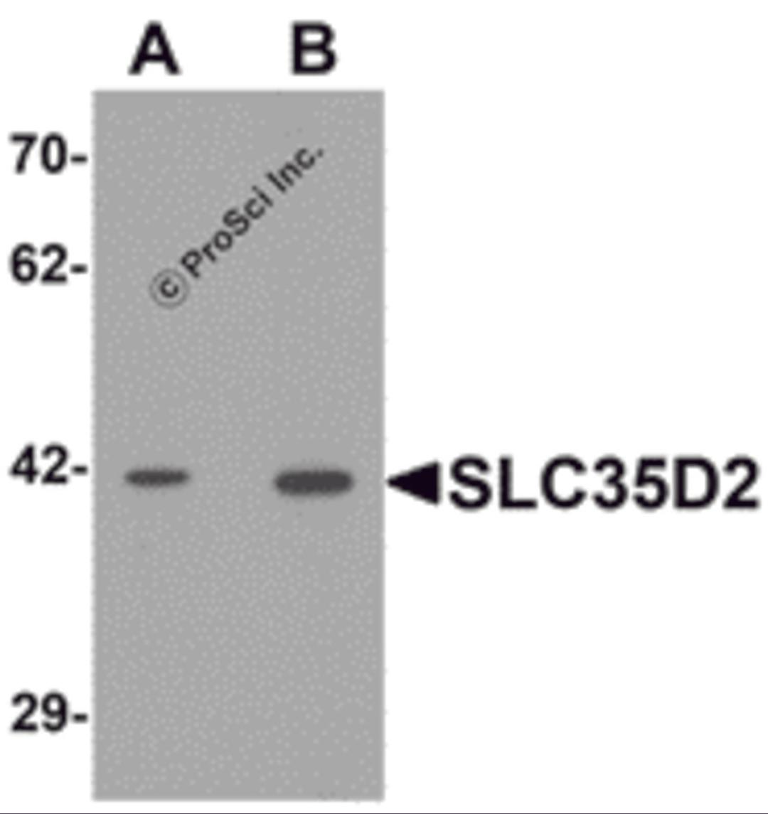 Western blot analysis of SLC35D2 in HeLa cell lysate with SLC35D2 antibody at (A) 1 and (B) 2 &#956;g/mL.