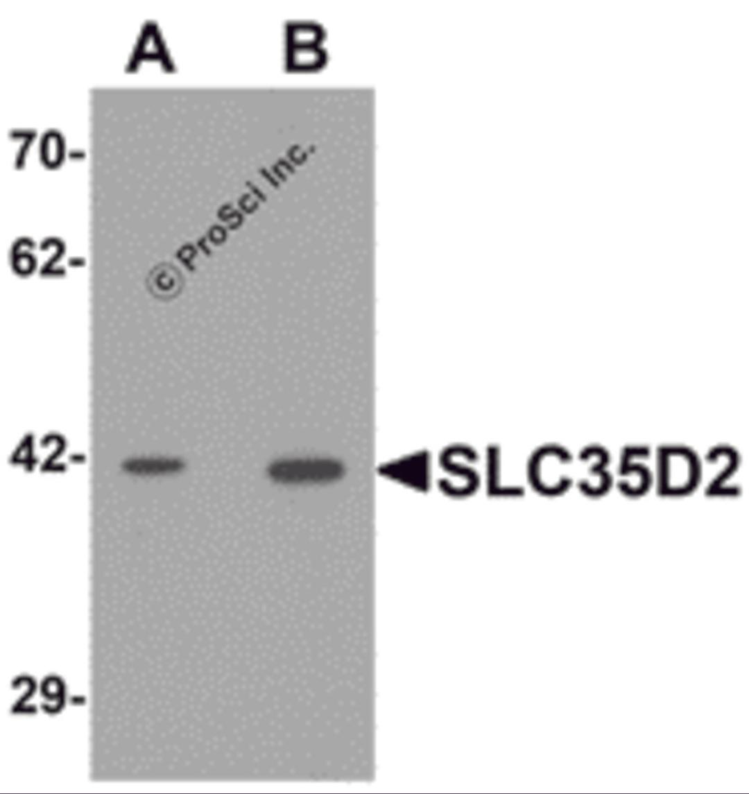 Western blot analysis of SLC35D2 in HeLa cell lysate with SLC35D2 antibody at (A) 1 and (B) 2 μg/mL.