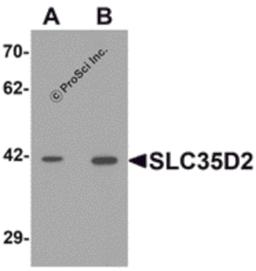 Western blot analysis of SLC35D2 in HeLa cell lysate with SLC35D2 antibody at (A) 1 and (B) 2 μg/mL.