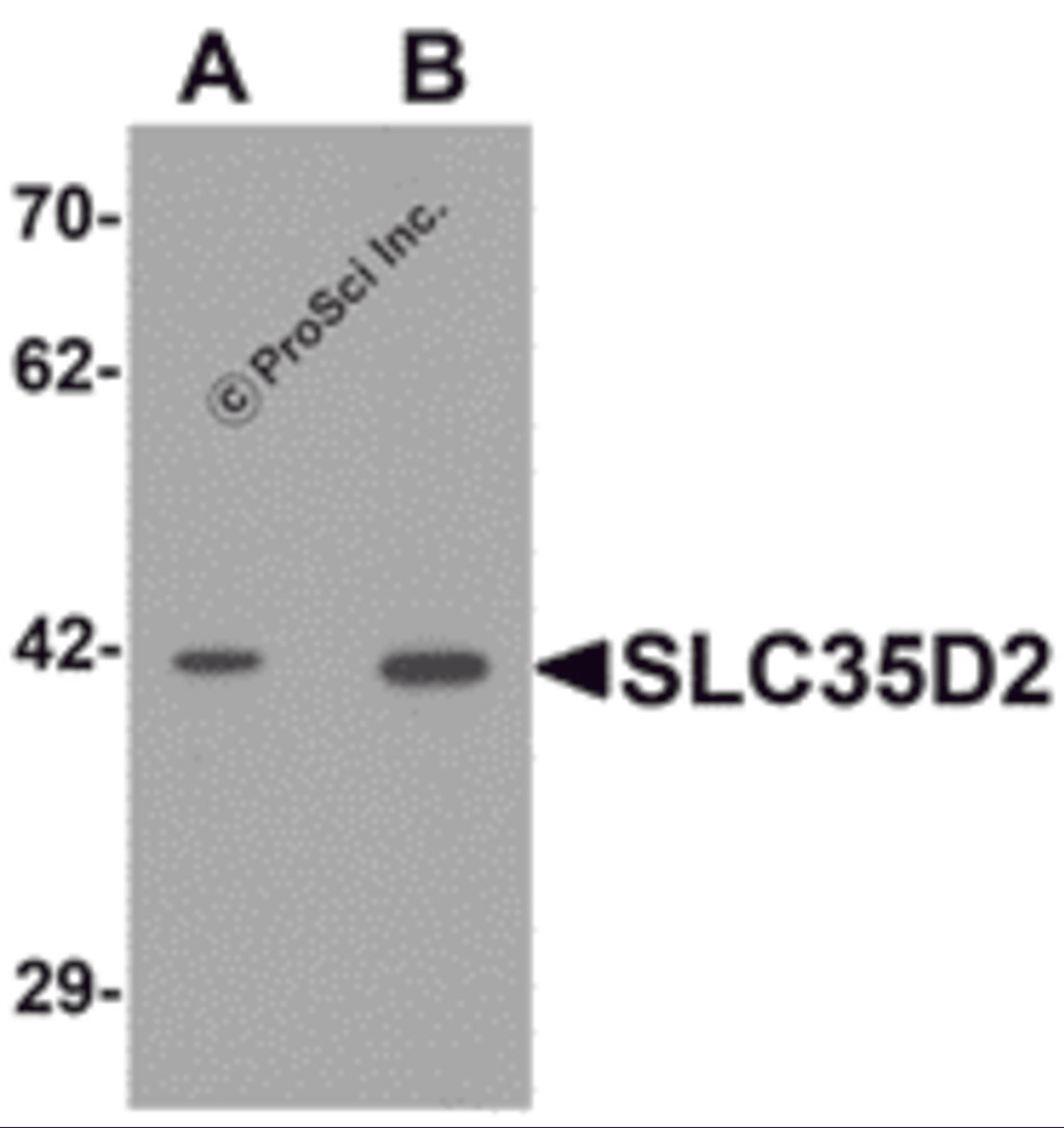 Western blot analysis of SLC35D2 in HeLa cell lysate with SLC35D2 antibody at (A) 1 and (B) 2 μg/mL.