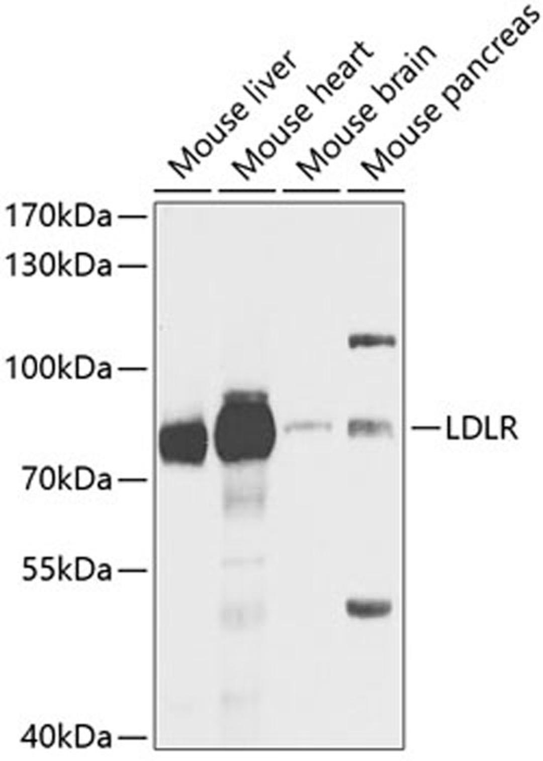 Western blot - IL31RA antibody (A6141)