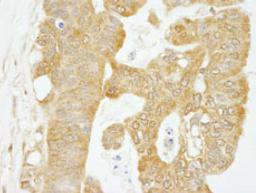 Detection of human eIF4G1/eIF4GI by immunohistochemistry.