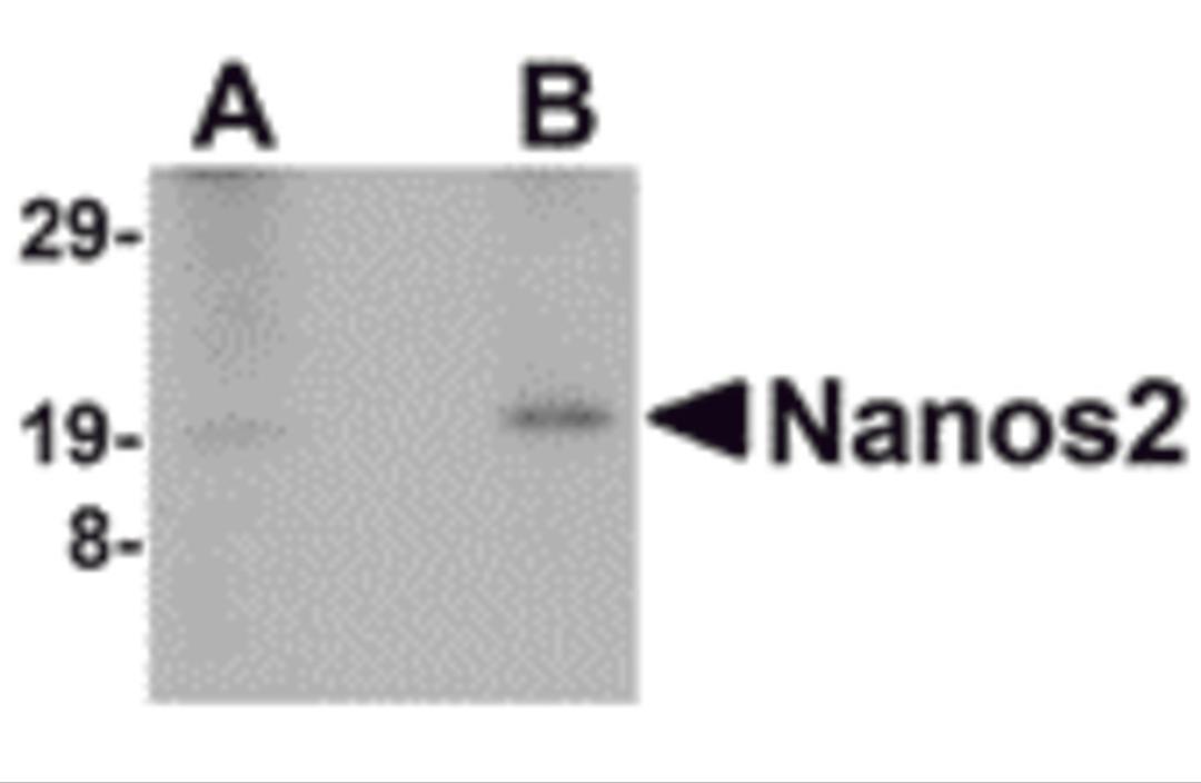 Western blot analysis of Nanos2 in human testis lyate with Nanos2 antibody at (A) 2 and (B) 4 μg/mL.
