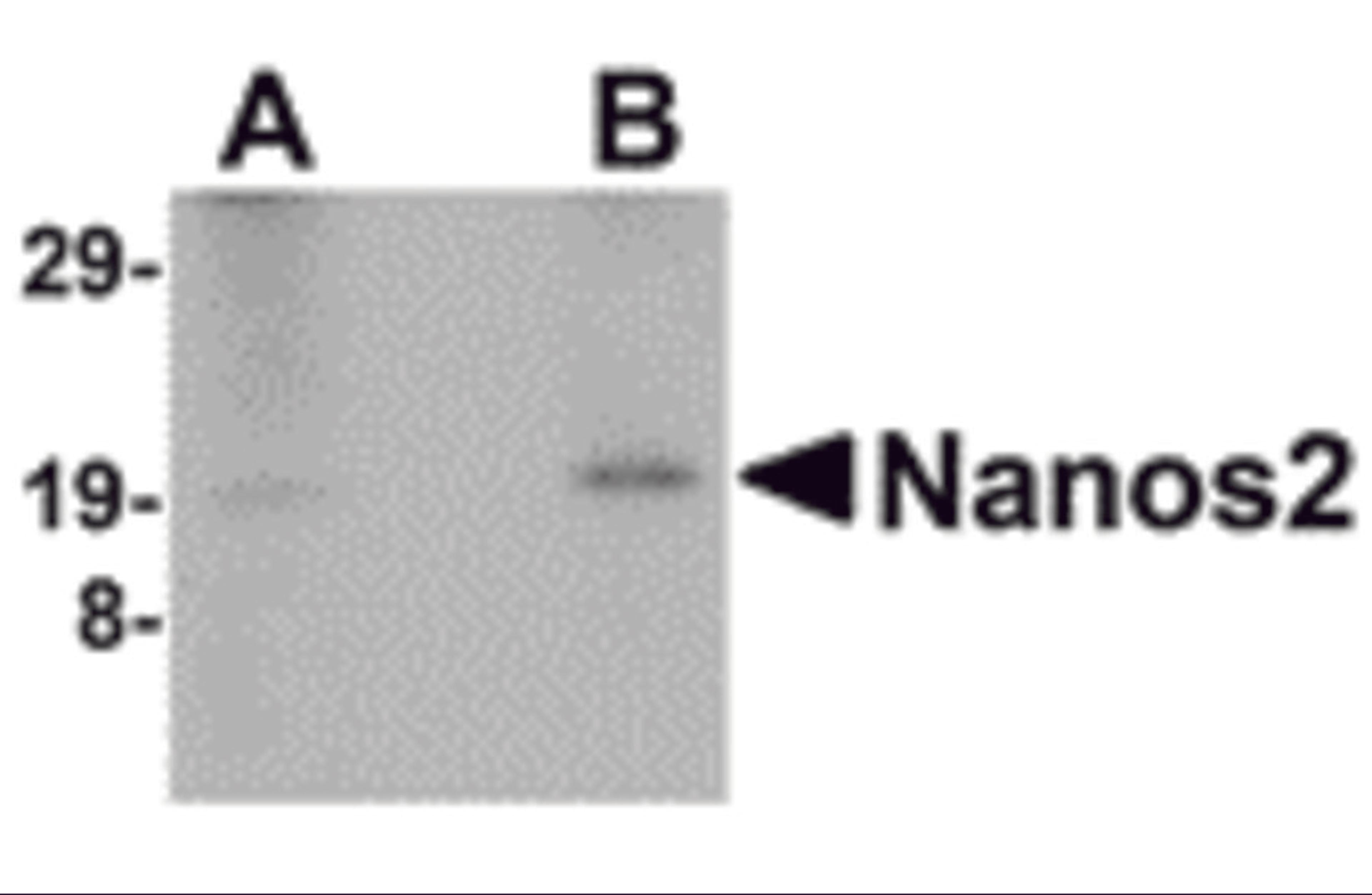 Western blot analysis of Nanos2 in human testis lyate with Nanos2 antibody at (A) 2 and (B) 4 μg/mL.