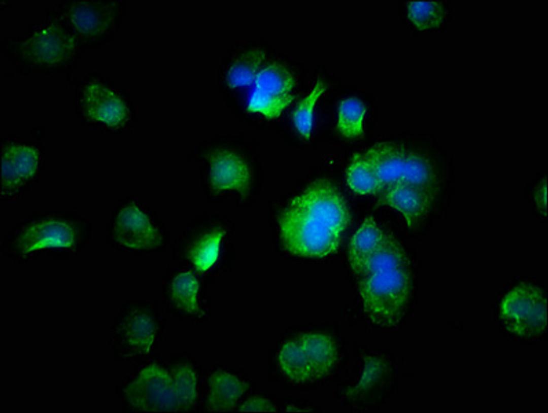 Immunofluorescence staining of MCF-7 cells with CSB-PA819458HA01HU at 1:333, counter-stained with DAPI. The cells were fixed in 4% formaldehyde, permeabilized using 0.2% Triton X-100 and blocked in 10% normal Goat Serum. The cells were then incubated with the antibody overnight at 4°C. The secondary antibody was Alexa Fluor 488-congugated AffiniPure Goat Anti-Rabbit IgG(H+L).