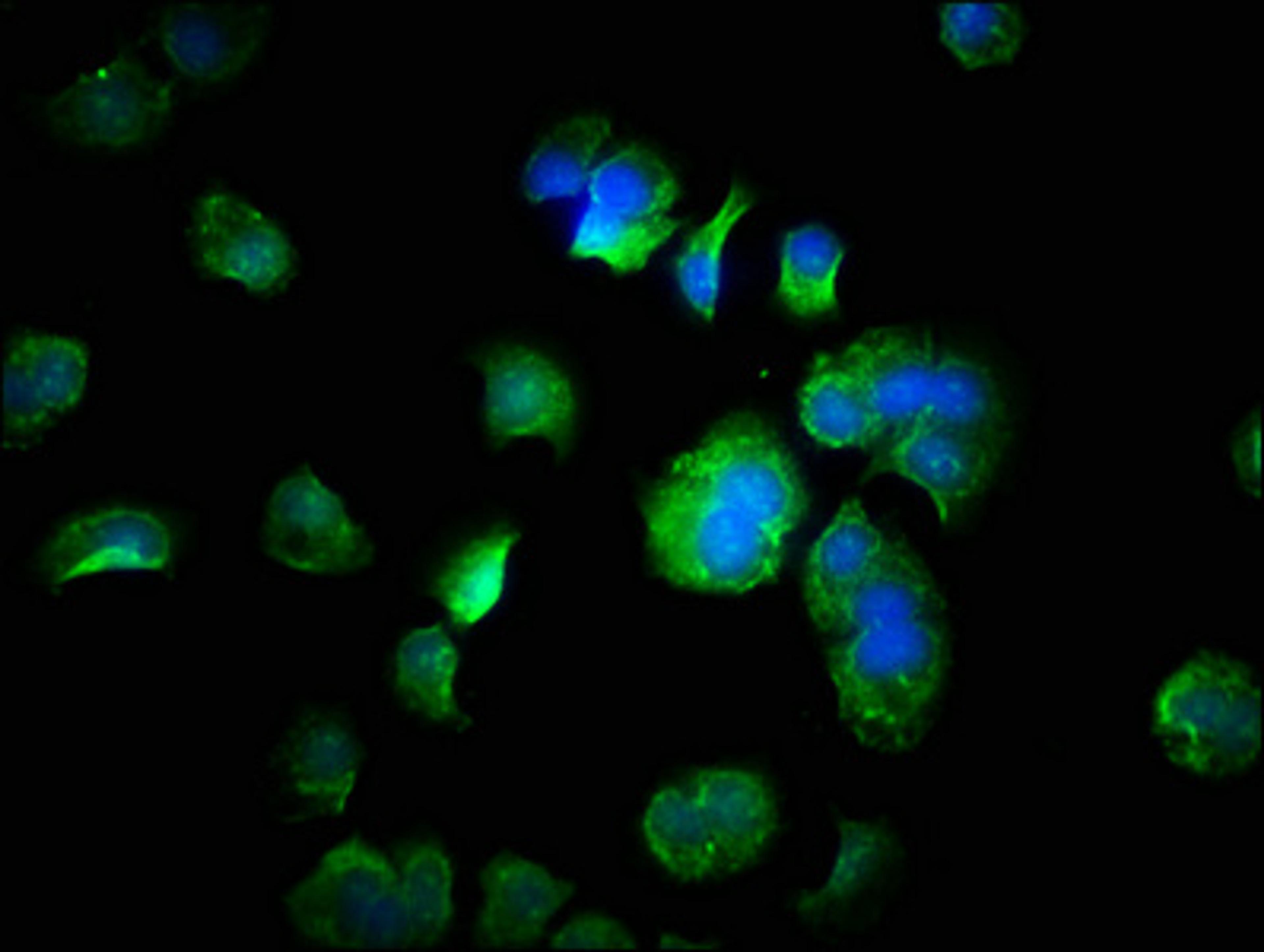 Immunofluorescence staining of MCF-7 cells with CSB-PA819458HA01HU at 1:333, counter-stained with DAPI. The cells were fixed in 4% formaldehyde, permeabilized using 0.2% Triton X-100 and blocked in 10% normal Goat Serum. The cells were then incubated with the antibody overnight at 4°C. The secondary antibody was Alexa Fluor 488-congugated AffiniPure Goat Anti-Rabbit IgG(H+L).
