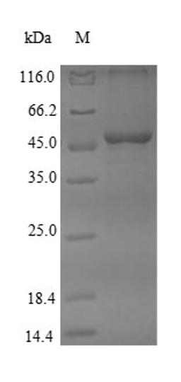 (Tris-Glycine gel) Discontinuous SDS-PAGE (reduced) with 5% enrichment gel and 15% separation gel.