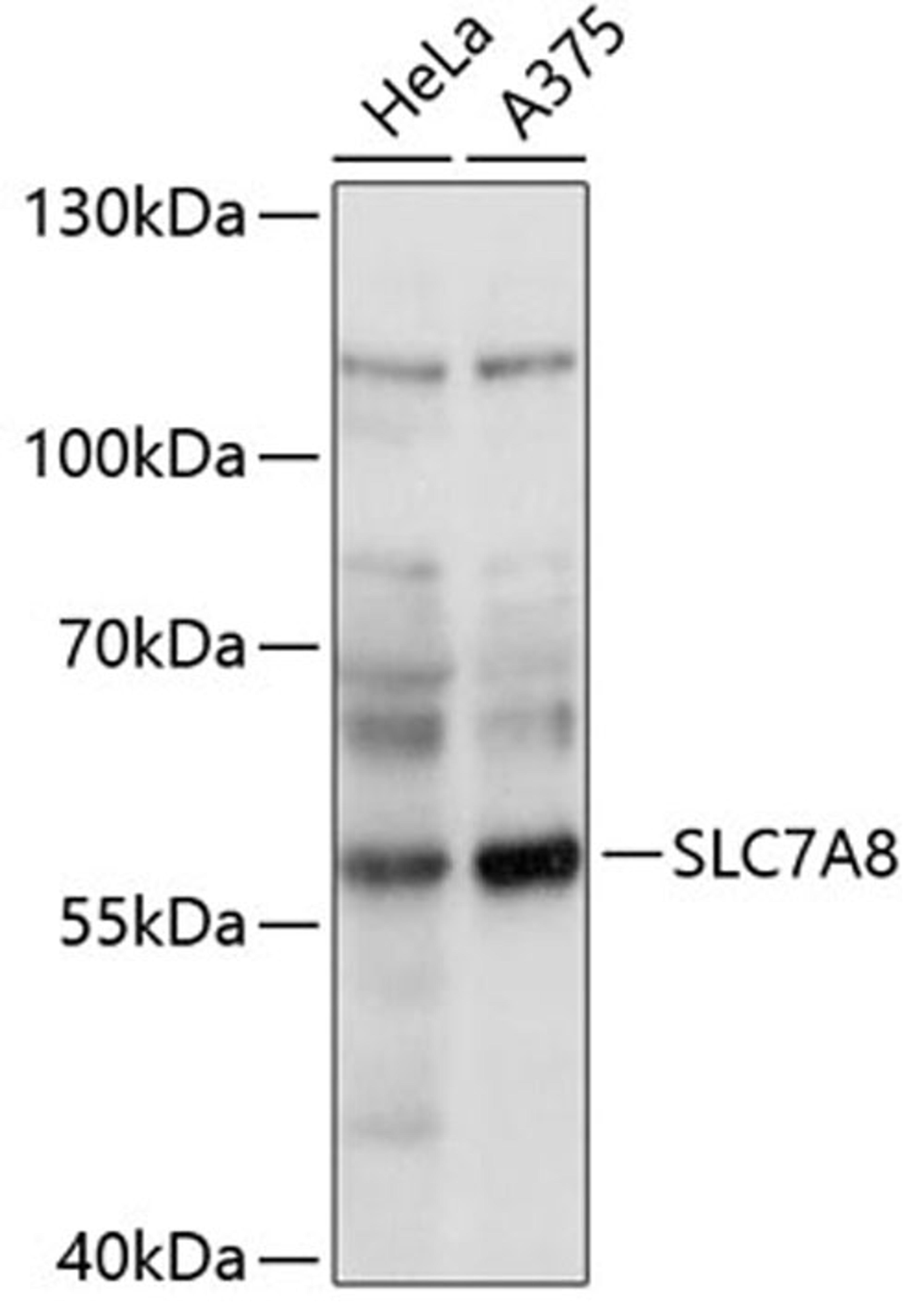 Western blot - SLC7A8 antibody (A14861)