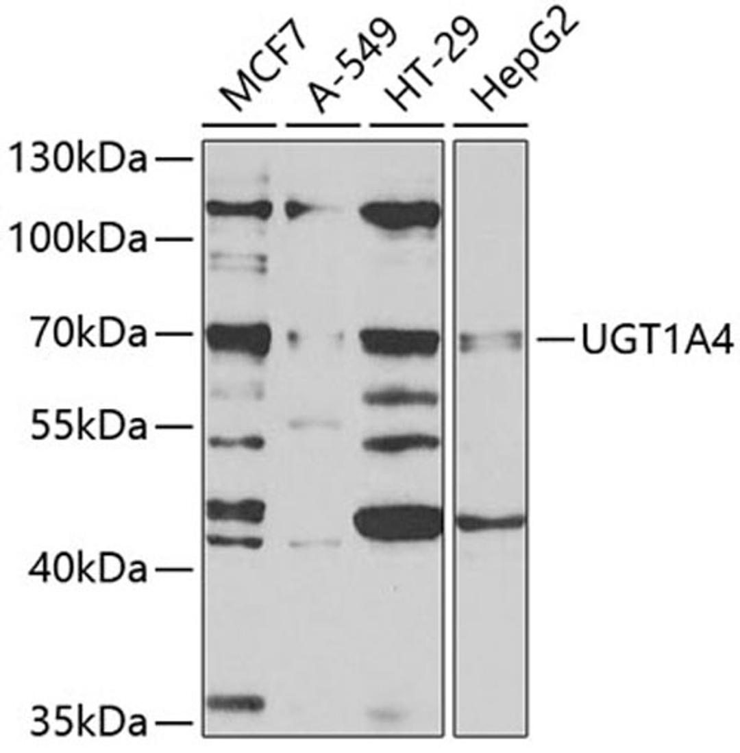 Western blot - UGT1A4 antibody (A5549)