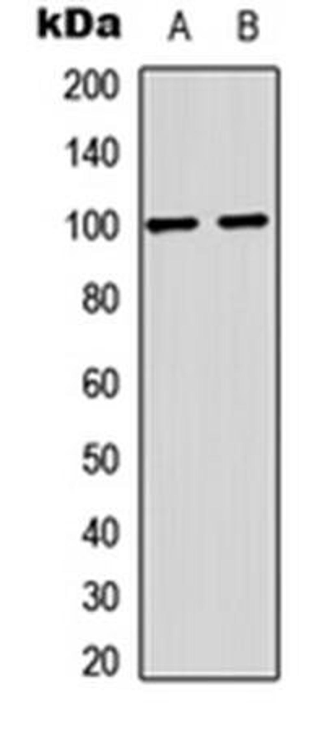 Western blot analysis of mouse brain (Lane1), rat brain (Lane2) whole cell using GLUR2 (phospho-S880) antibody