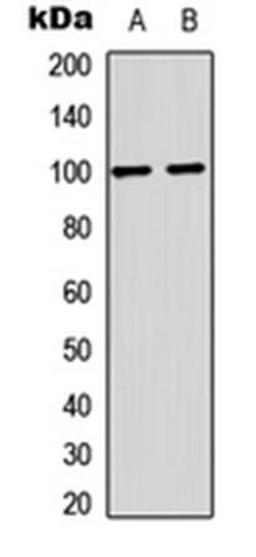 Western blot analysis of mouse brain (Lane1), rat brain (Lane2) whole cell using GLUR2 (phospho-S880) antibody