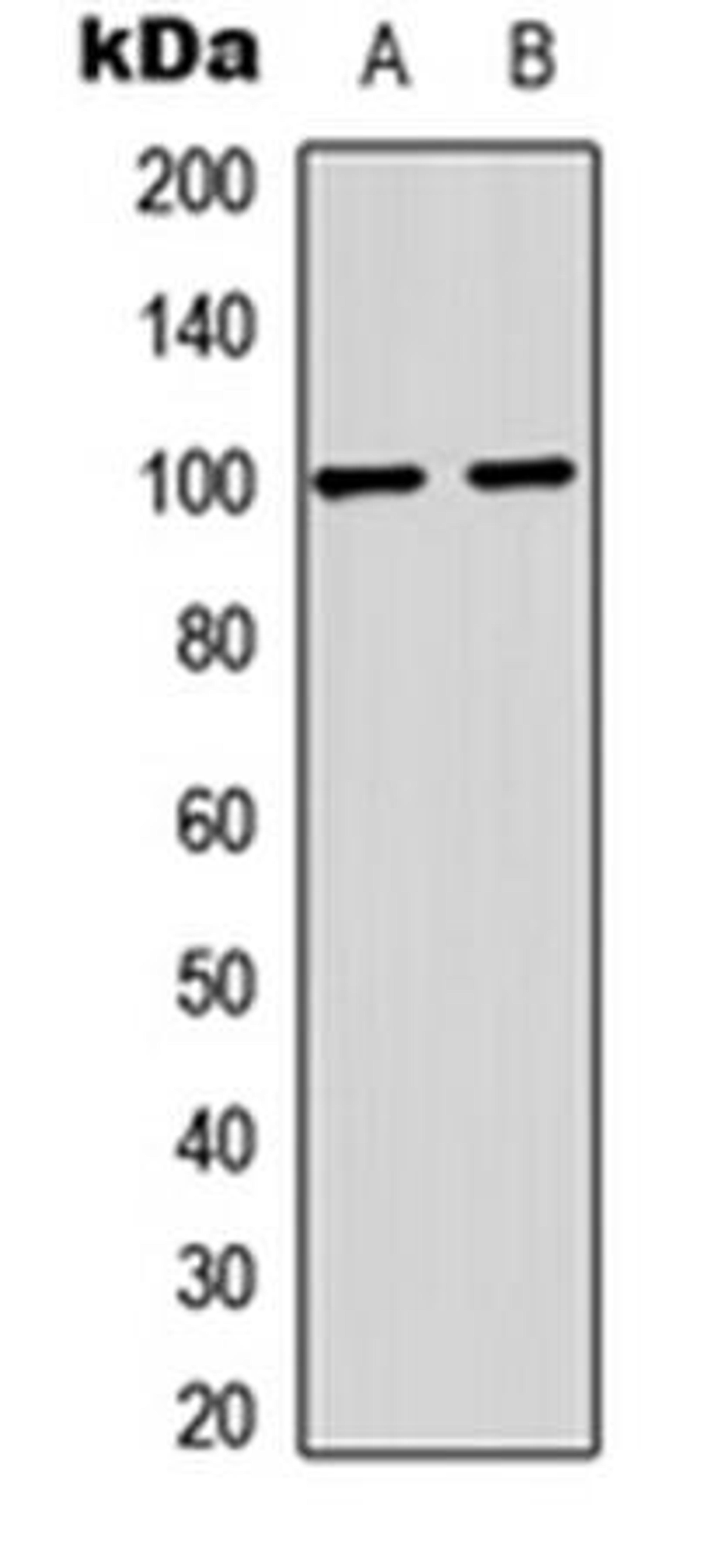 Western blot analysis of mouse brain (Lane1), rat brain (Lane2) whole cell using GLUR2 (phospho-S880) antibody