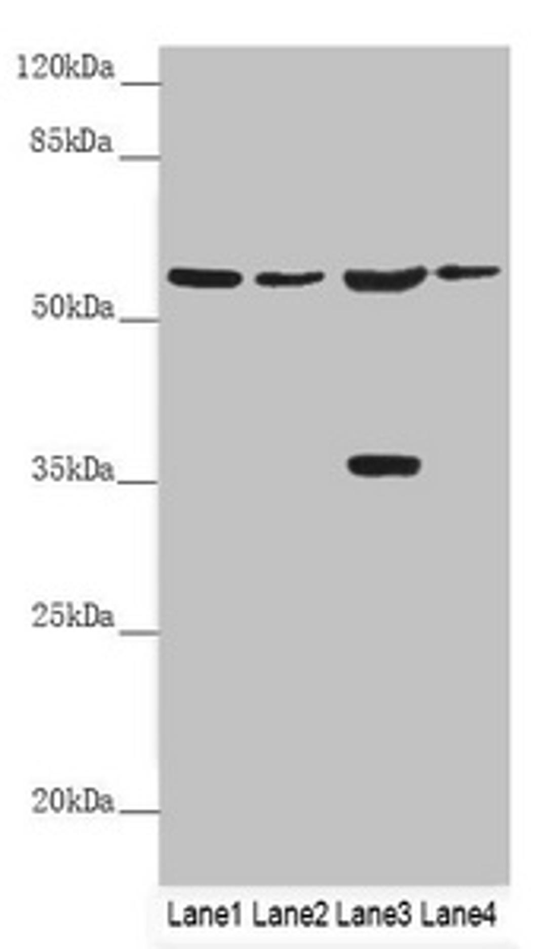 Western blot. All lanes: SLC1A5 antibody at 9.89 ug/ml. Lane 1: Mouse lung tissue. Lane 2: Jurkat whole cell lysate. Lane 3: 293T whole cell lysate. Lane 4: Hela whole cell lysate. Secondary. Goat polyclonal to rabbit IgG at 1/10000 dilution. Predicted band size: 57, 37, 34 kDa. Observed band size: 57, 37 kDa.