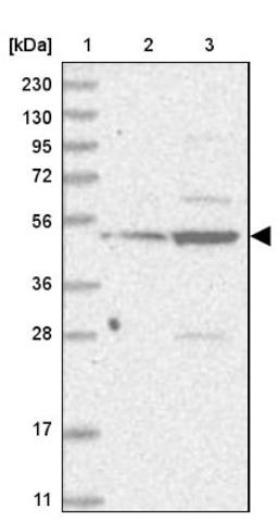 Western Blot: IL11RA Antibody [NBP2-32671] - Lane 1: Marker [kDa] 230, 130, 95, 72, 56, 36, 28, 17, 11<br/>Lane 2: Human cell line RT-4<br/>Lane 3: Human cell line U-251MG sp