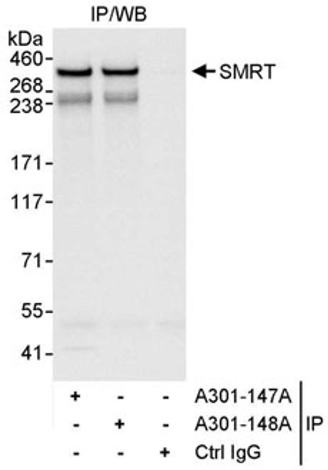 Detection of human SMRT by western blot of immunoprecipitates.