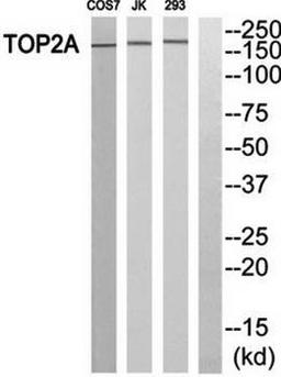 Western blot analysis of extracts from HT-29 cells using TOP2A antibody