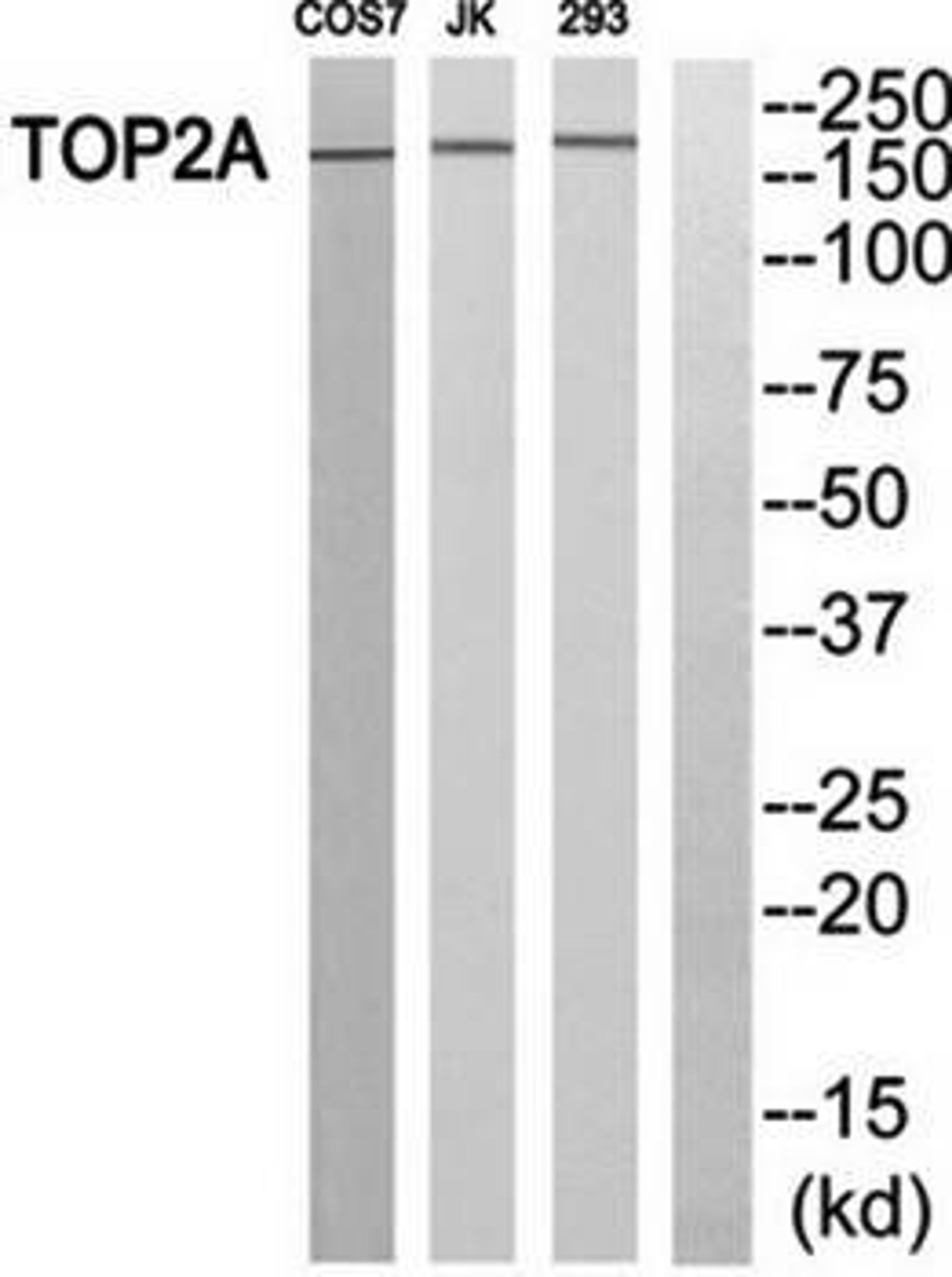 Western blot analysis of extracts from HT-29 cells using TOP2A antibody