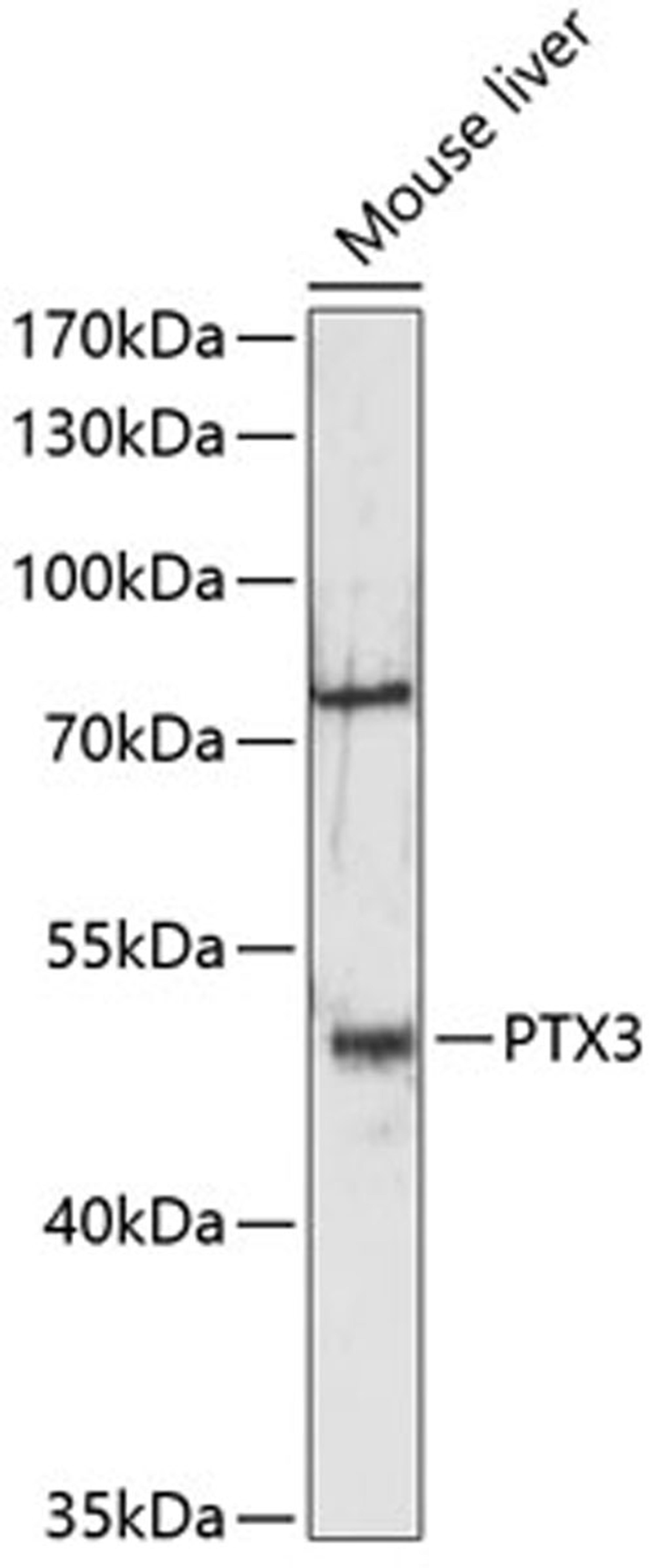 Western blot - PTX3 antibody (A12670)