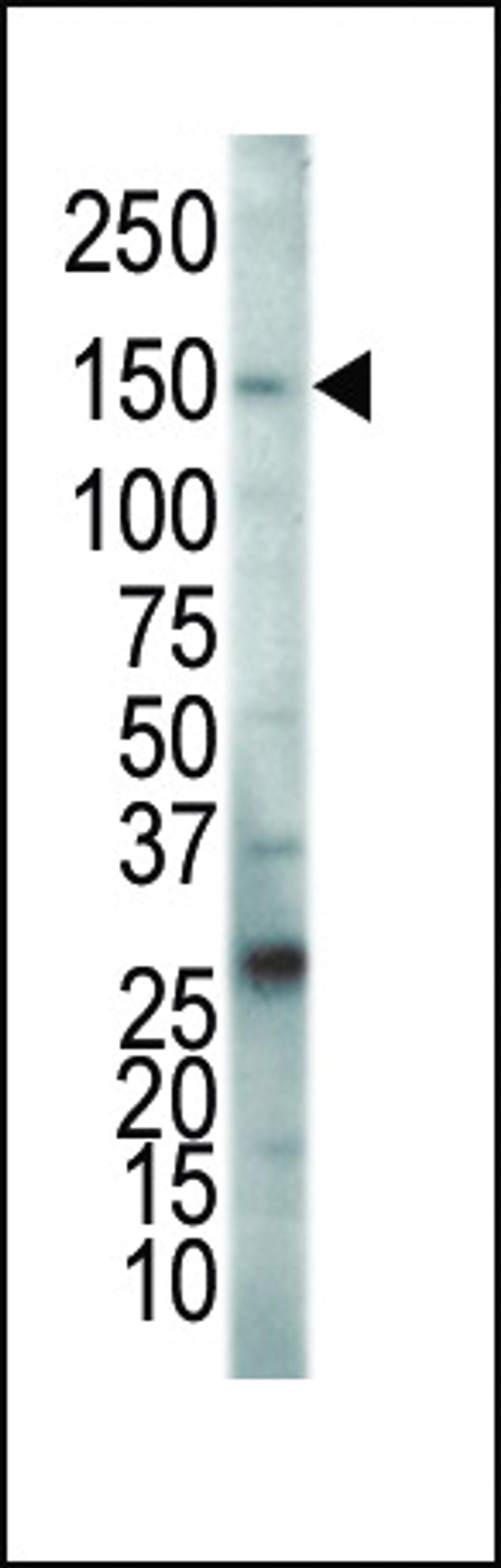 Western blot analysis of anti-KDR/FLK1 Pab in HeLa cell lysate. KDR (VEGFR2) was detected using purified Pab.