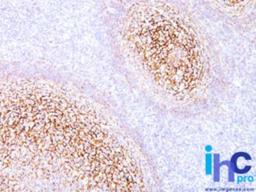 Immunohistochemistry-Paraffin: CD35 Antibody (E11) [NBP2-29460] - Formalin-fixed, paraffin-embedded human tonsil stained with CD35 antibody at 1:200 using peroxidase-conjugate and DAB chromogen. Note membrane staining.