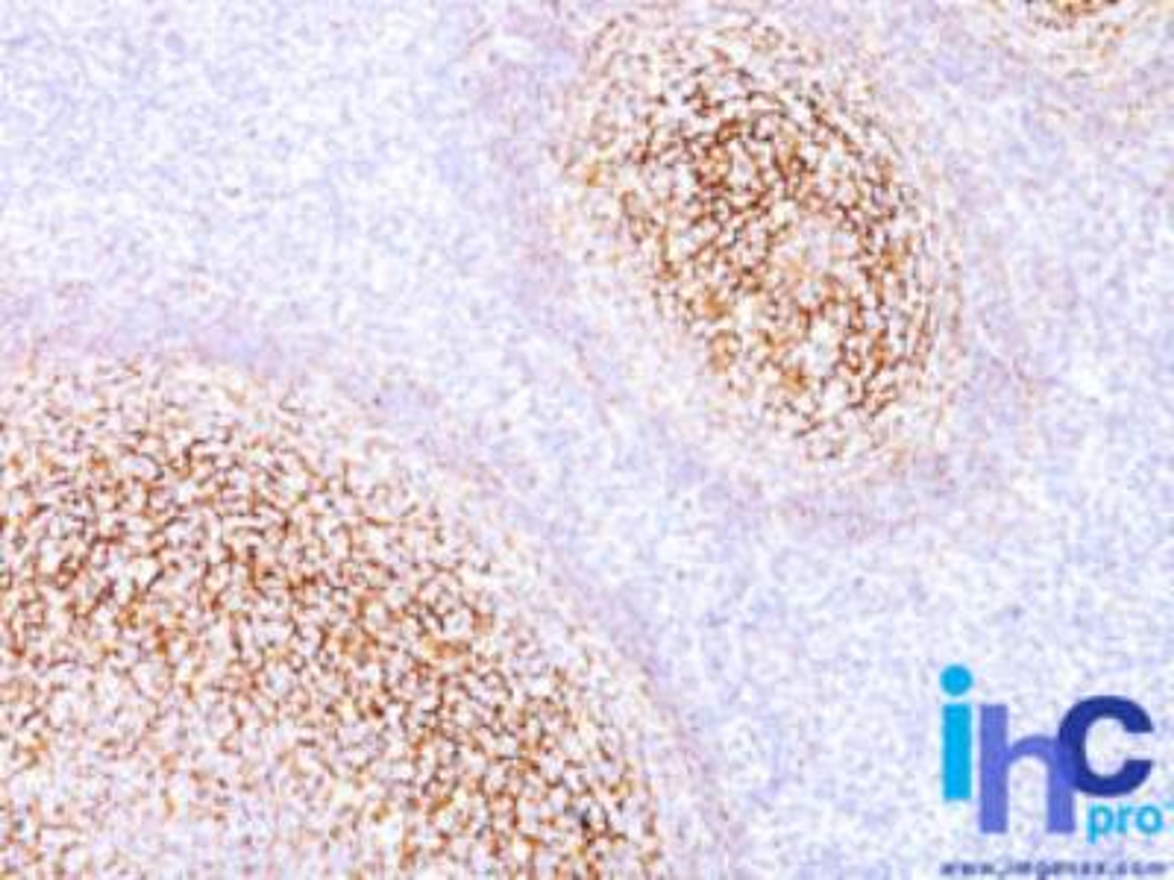 Immunohistochemistry-Paraffin: CD35 Antibody (E11) [NBP2-29460] - Formalin-fixed, paraffin-embedded human tonsil stained with CD35 antibody at 1:200 using peroxidase-conjugate and DAB chromogen. Note membrane staining.