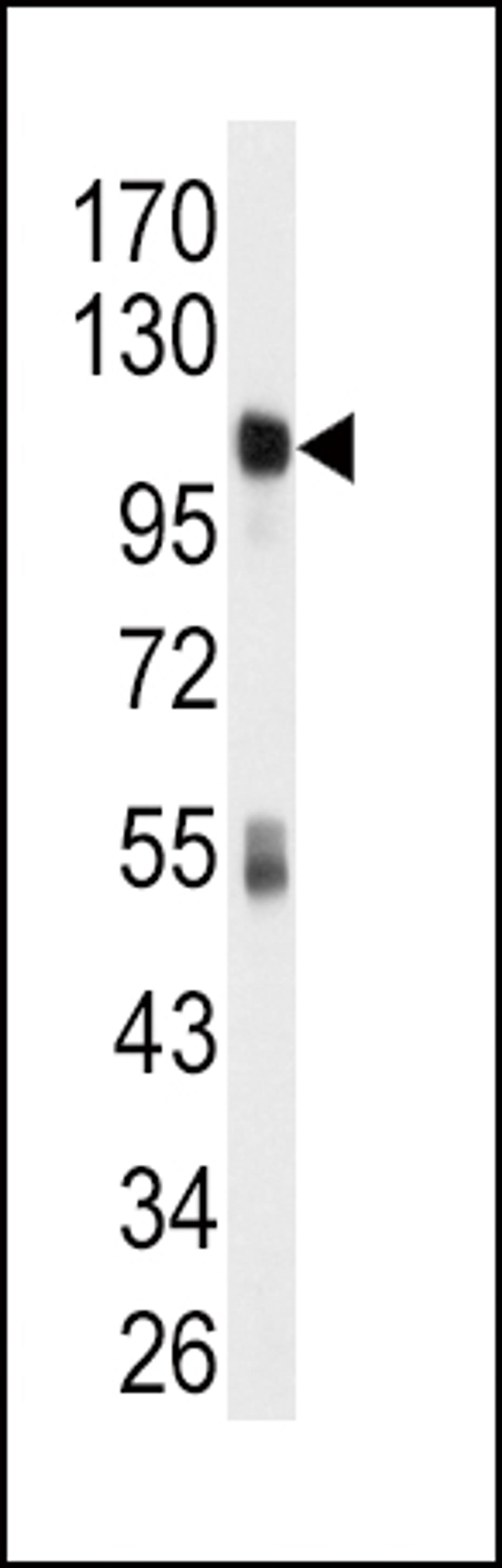 Western blot analysis of anti-ALDH1L1 Antibody in mouse liver tissue lysates (35ug/lane).