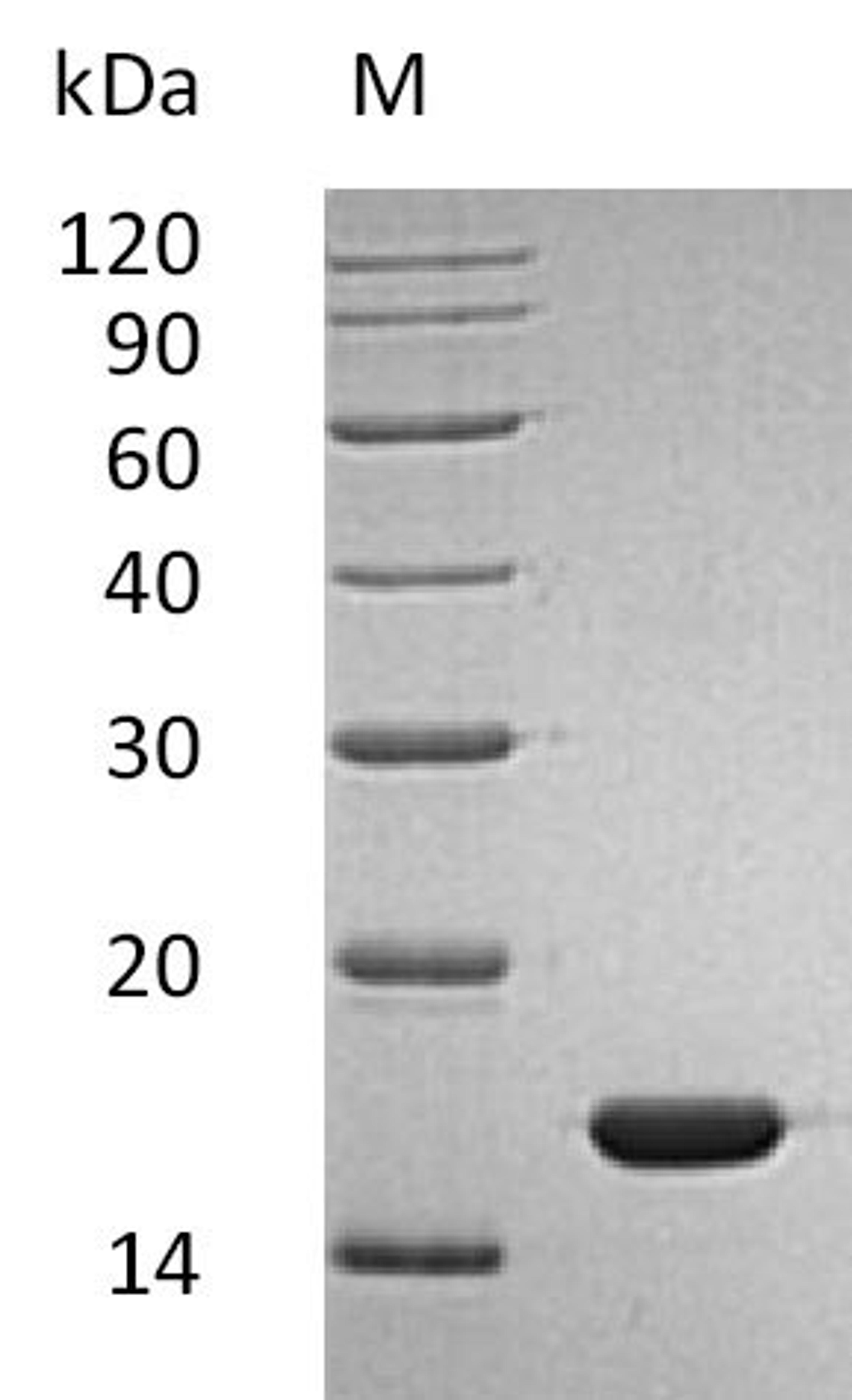 (Tris-Glycine gel) Discontinuous SDS-PAGE (reduced) with 5% enrichment gel and 15% separation gel.