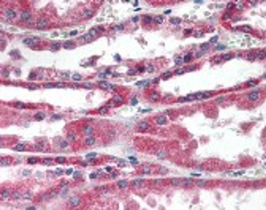 Immunohistochemistry staining of RDH11 in kidney: formalin-fixed paraffin-embeded (ffpe)RDH11 Antibody.