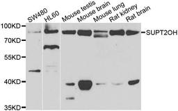 Western blot analysis of extracts of various cell lines using SUPT20H antibody