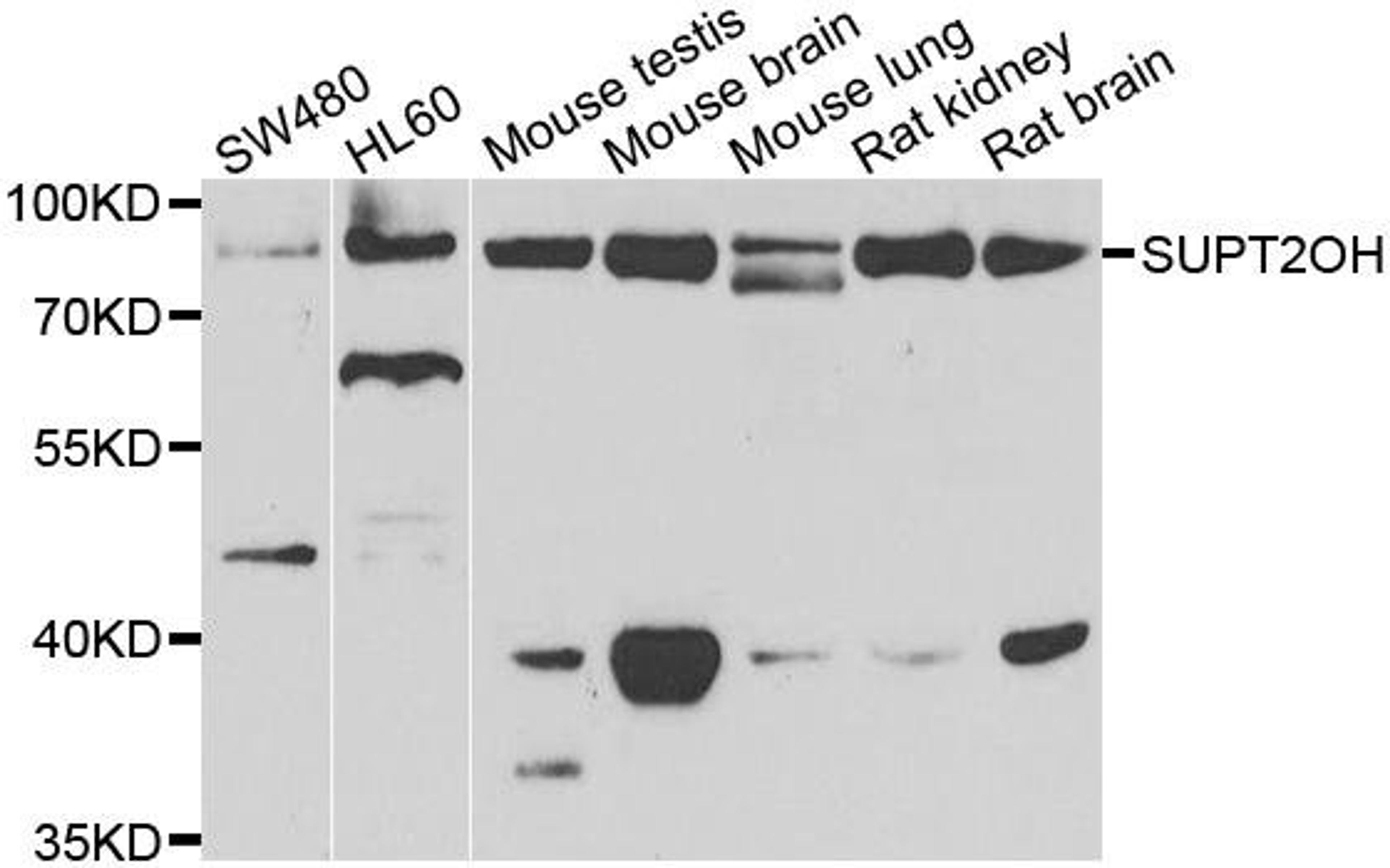 Western blot analysis of extracts of various cell lines using SUPT20H antibody