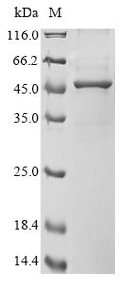 (Tris-Glycine gel) Discontinuous SDS-PAGE (reduced) with 5% enrichment gel and 15% separation gel.