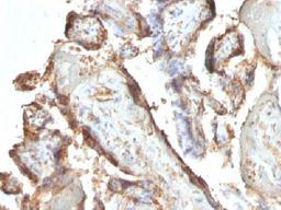 Immunohistochemical staining of human Placenta tissue using HCG Holo antibody