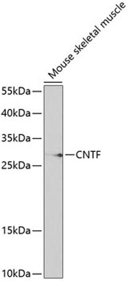 Western blot - CNTF antibody (A1915)