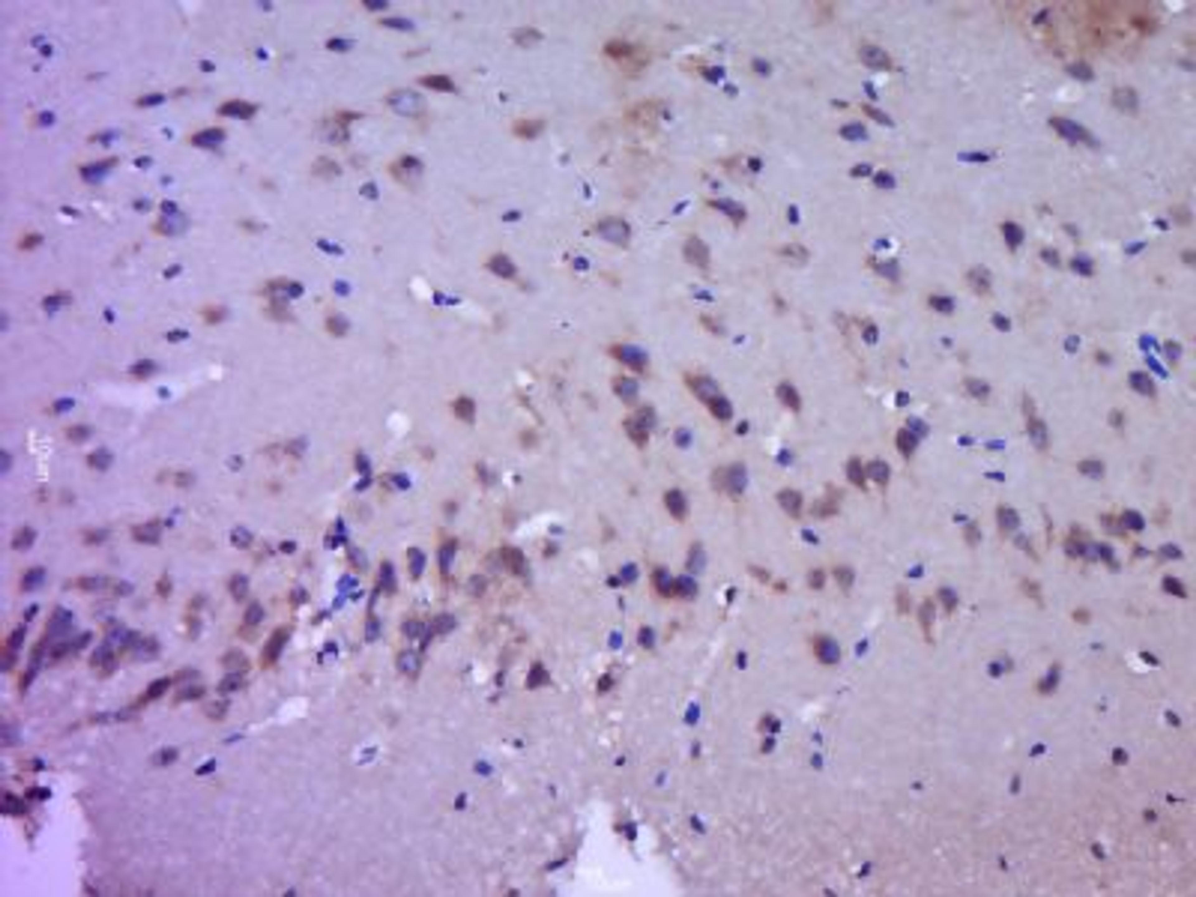 Immunohistochemical staining of rat brain tissue using IGF 1 antibody.