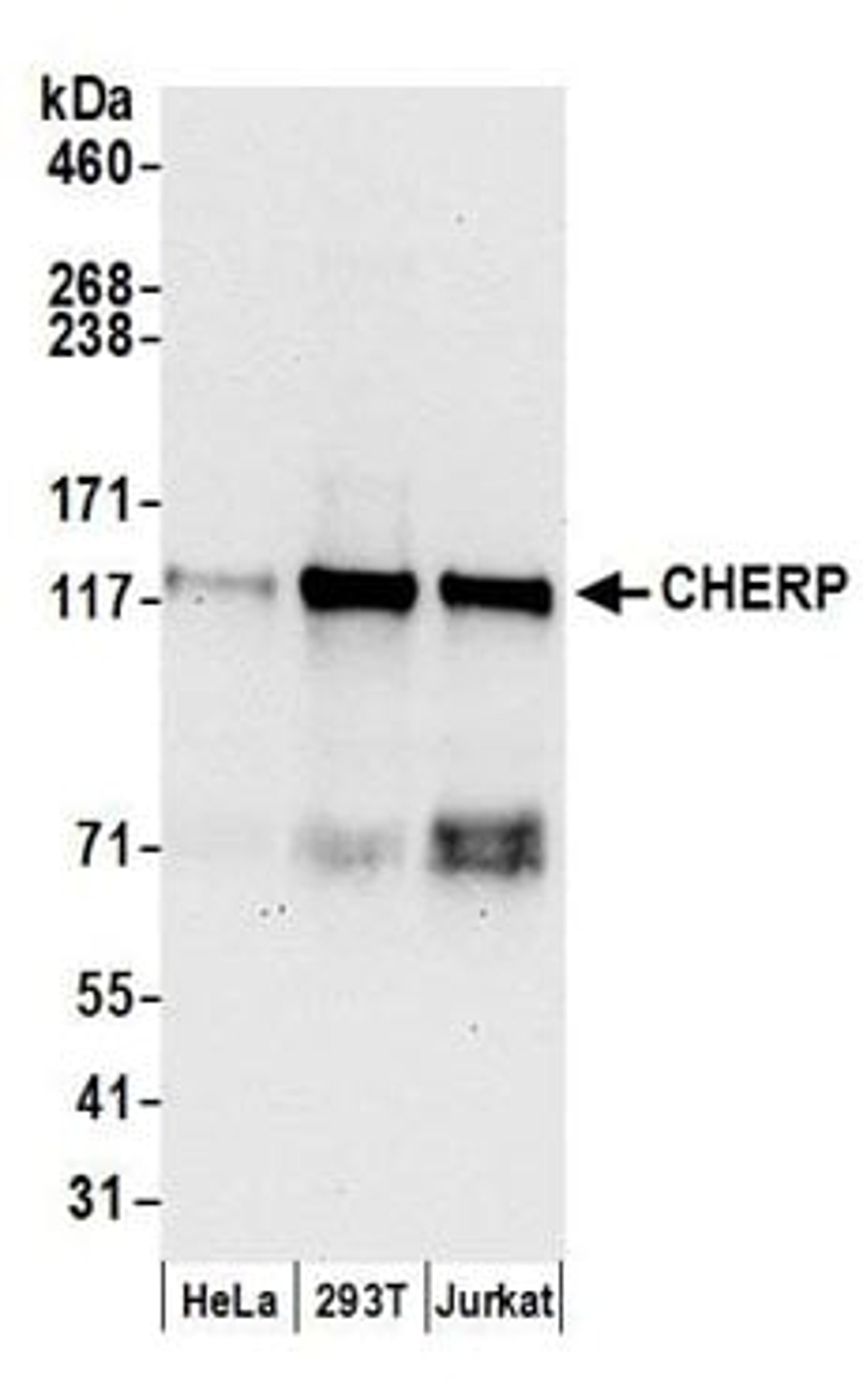 Detection of human CHERP by western blot.